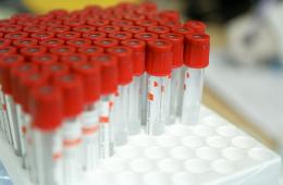 27.12.2023 Более 30 миллионов рублей направлено на профилактику ВИЧ в Приморье. ИТОГИ ГОДА | Администрация муниципального округа город Партизанск Приморского края Официальный сайт